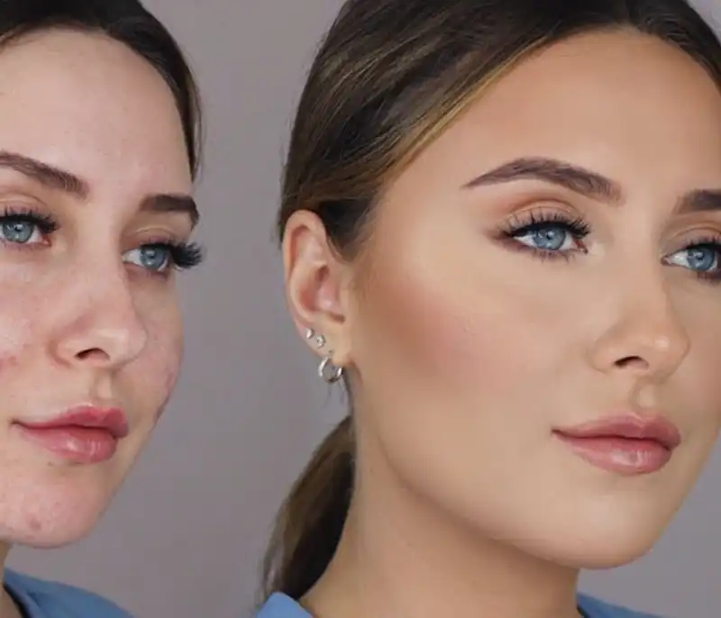 تکنیک استفاده از پرایمر