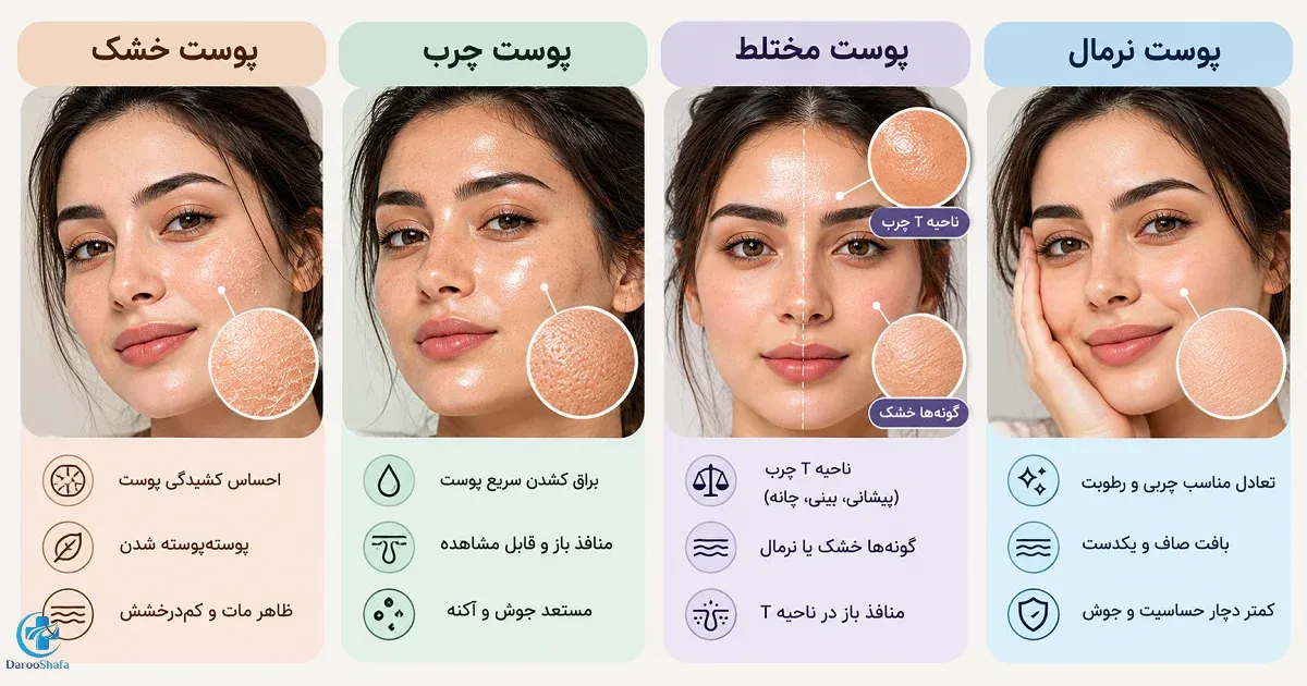 مقایسه پوست خشک، چرب، مختلط و نرمال
