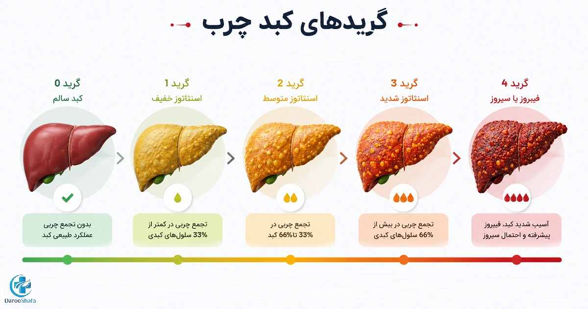 اینفوگرافیک گریدهای کبد چرب از کبد سالم تا فیبروز و سیروز کبد