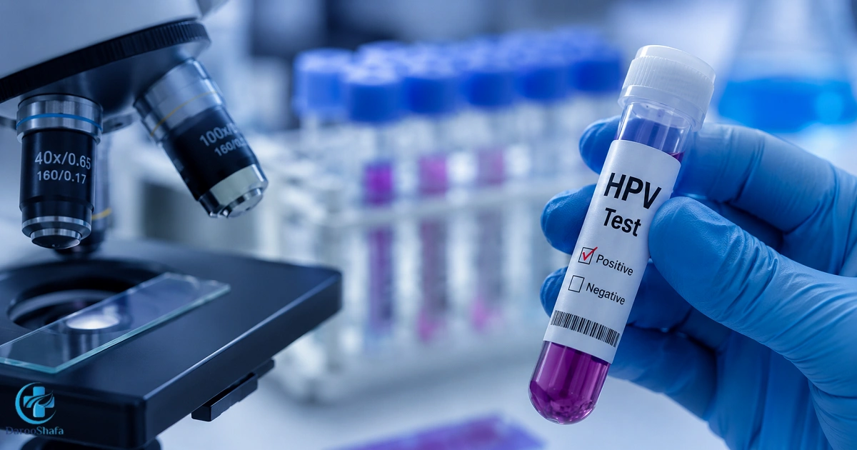 نمونه آزمایش HPV در آزمایشگاه برای تشخیص ویروس پاپیلومای انسانی