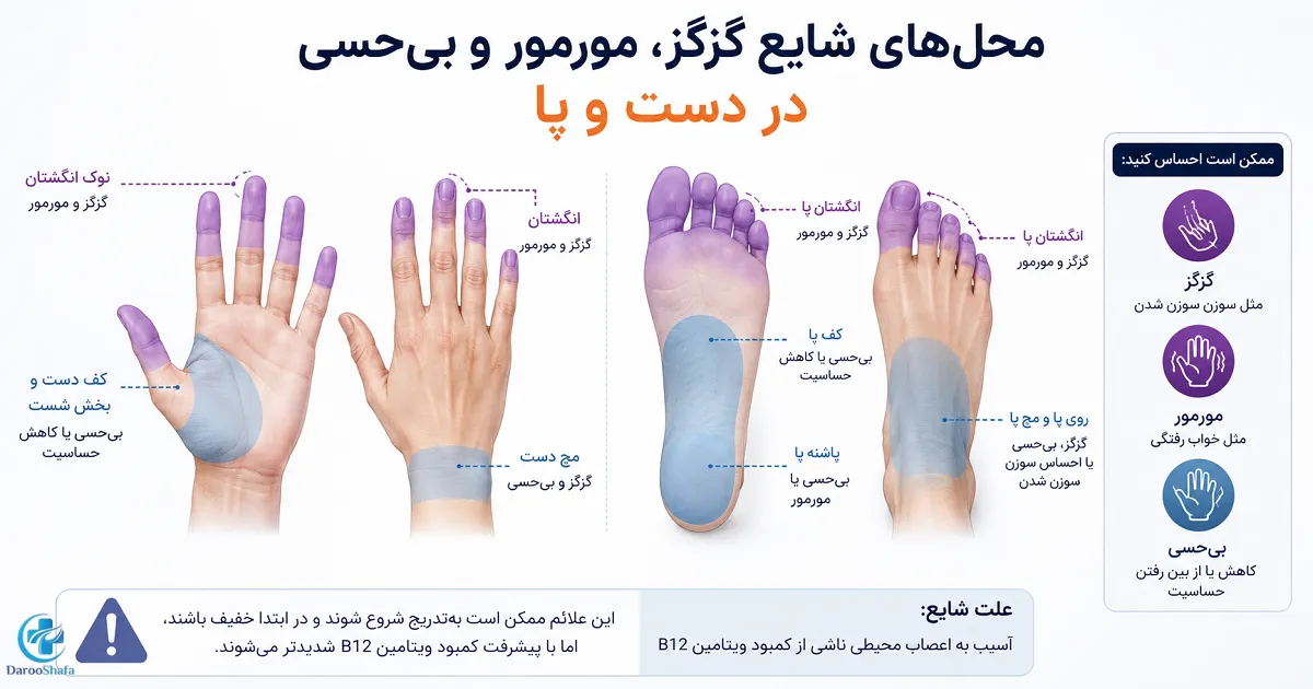 محل های شایع گزگز، مورمور و بی حسی در دست و پا