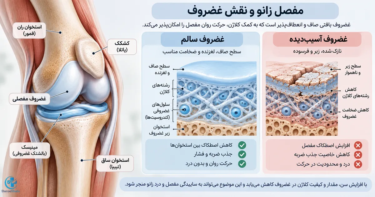 نقش کلاژن برای افراد بالای ۴۰ سال در ساختار غضروف و مقایسه غضروف سالم و آسیب دیده زانو