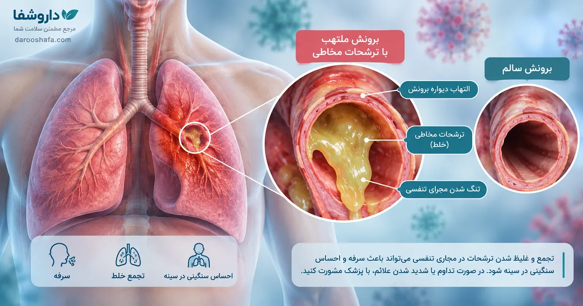 تجمع خلط و التهاب برونش در عفونت های تنفسی