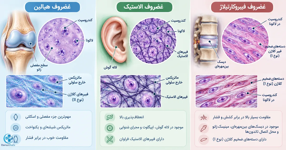 مقایسه ساختار غضروف هیلاین، غضروف الاستیک و فیبروکارتیلاژ