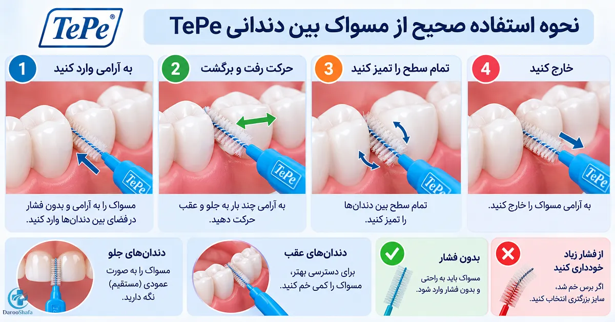 آموزش مرحله به مرحله نحوه استفاده صحیح از مسواک بین دندانی تپه بدون فشار به لثه